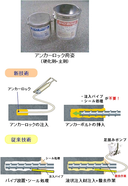 アンカーロック (CB-110015-VE) アンカーロック (CB-110015-VE)